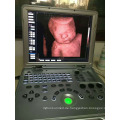 3D-4D-Baby-Farb-Doppler-Ultraschall und Echtzeit-3D-Scanner